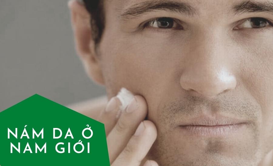 Nám da ở nam giới: Nguyên nhân và cách chữa hiệu quả
